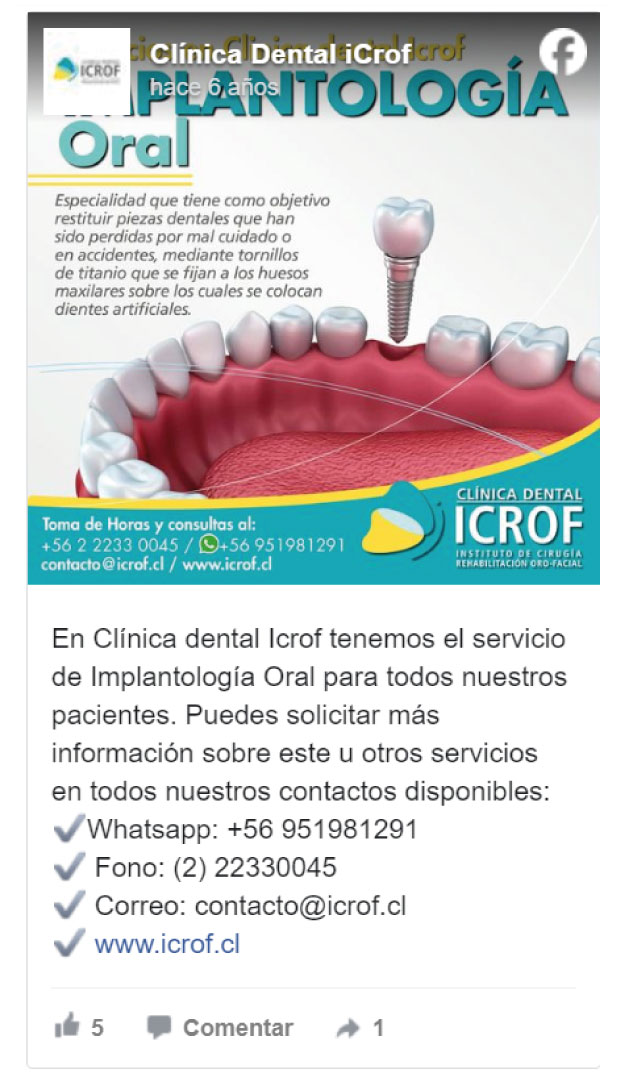 Implantología Oral - Clínica Dental ICROF - Vitacura - Las Condes