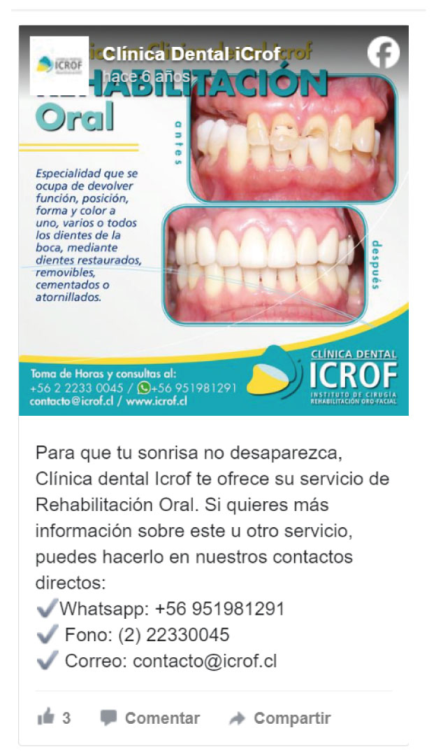 Rehabilitación Oral - Clínica Dental ICROF - Vitacura - Las Condes